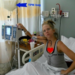Picture showing how the setup is for TPN